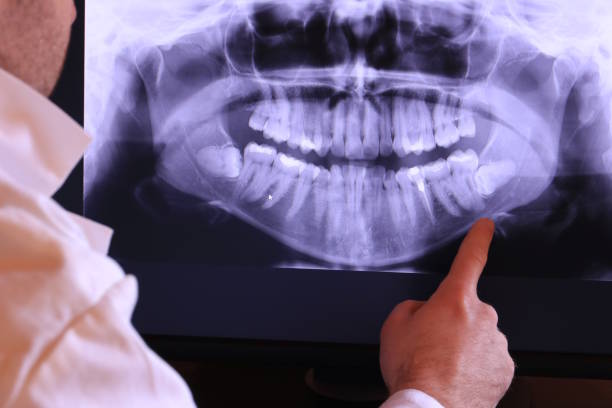 Best Urgent Care for Lost Fillings or Crowns in Shinglehouse, PA
