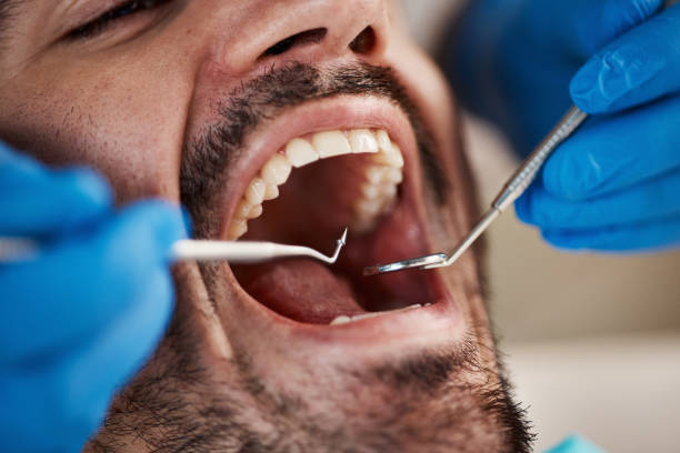 Best Emergency Gum Treatment in Shinglehouse, PA